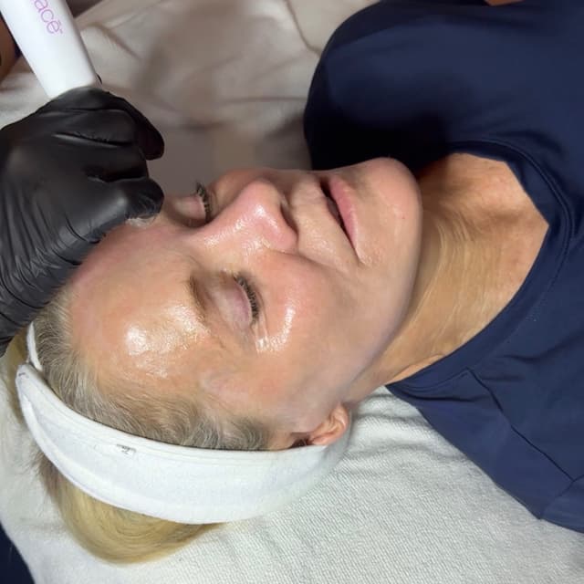 Event glacé Elite (6) bundle at Skinfinity & Beyond in Davidson, NC
